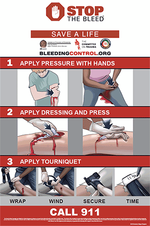 The Stop the Bleed program trains the public to act as immediate responders, applying pressure, dressings and tourniquets to wounds.