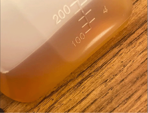 B) Urine output 