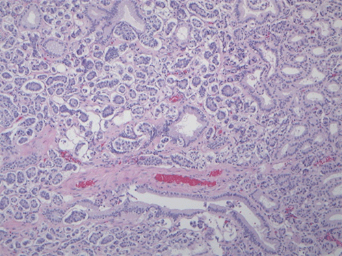 Hematoxylin and eosin (H&E) staining