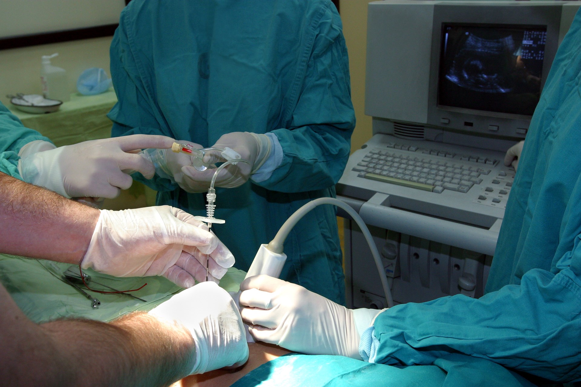 To Boldly Go Where No Mango Has Gone Before: A Bezoar Case of Small Bowel Obstruction