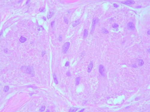 B. 400x magnification: granular cytoplasm