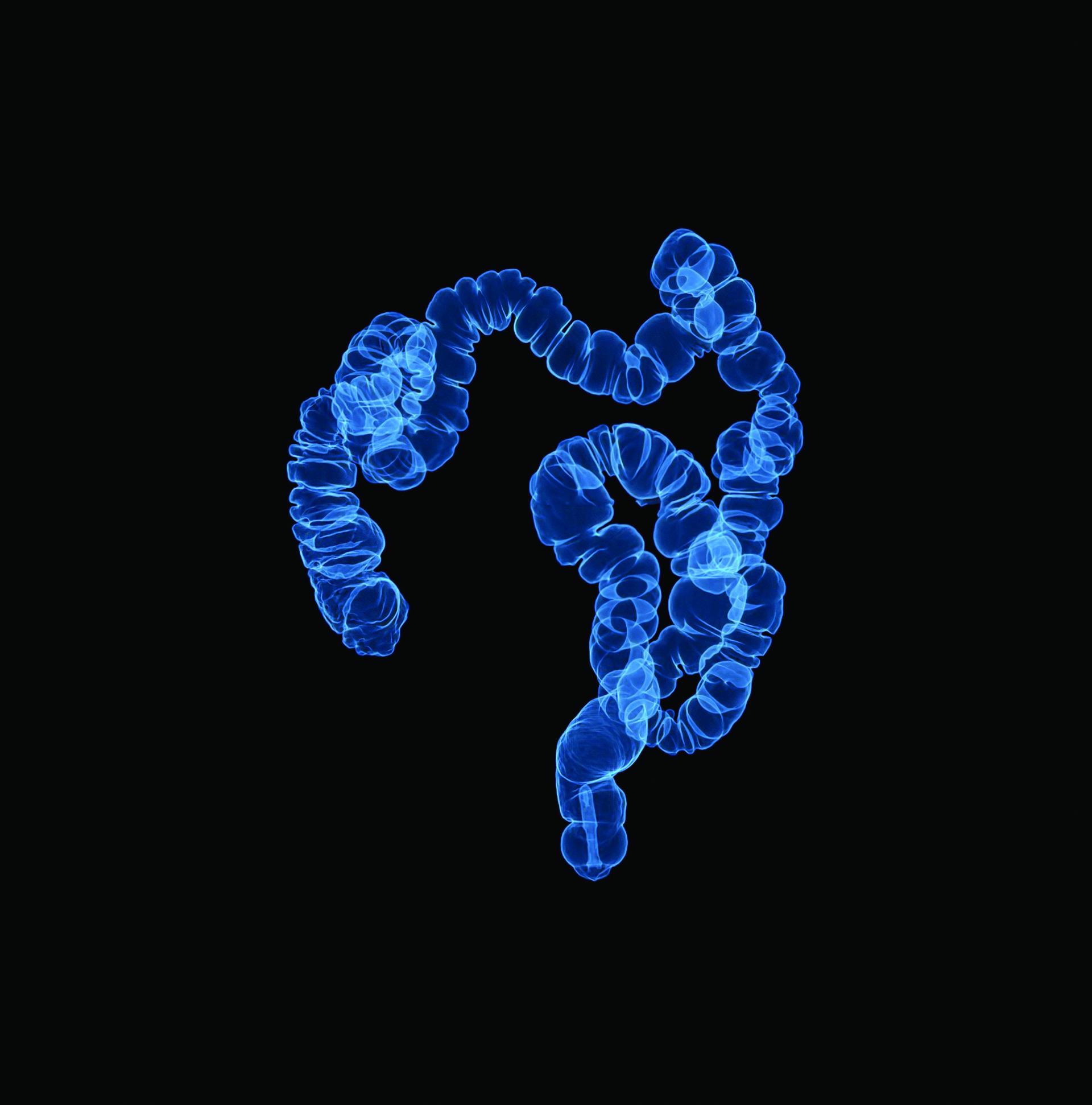 Know the Symptoms of Colorectal Cancer