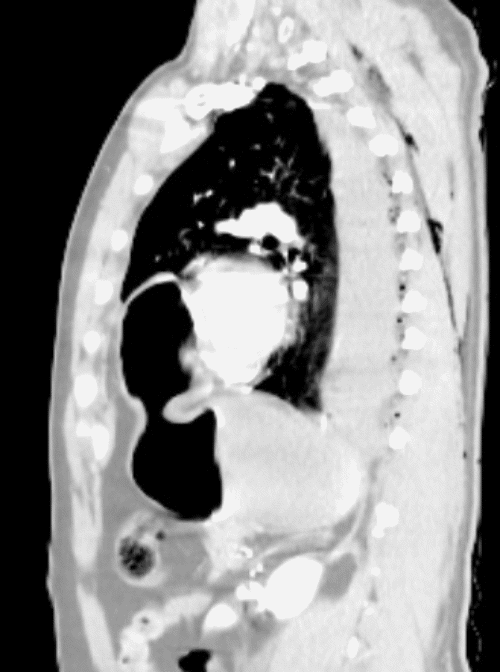 C) Sagittal View