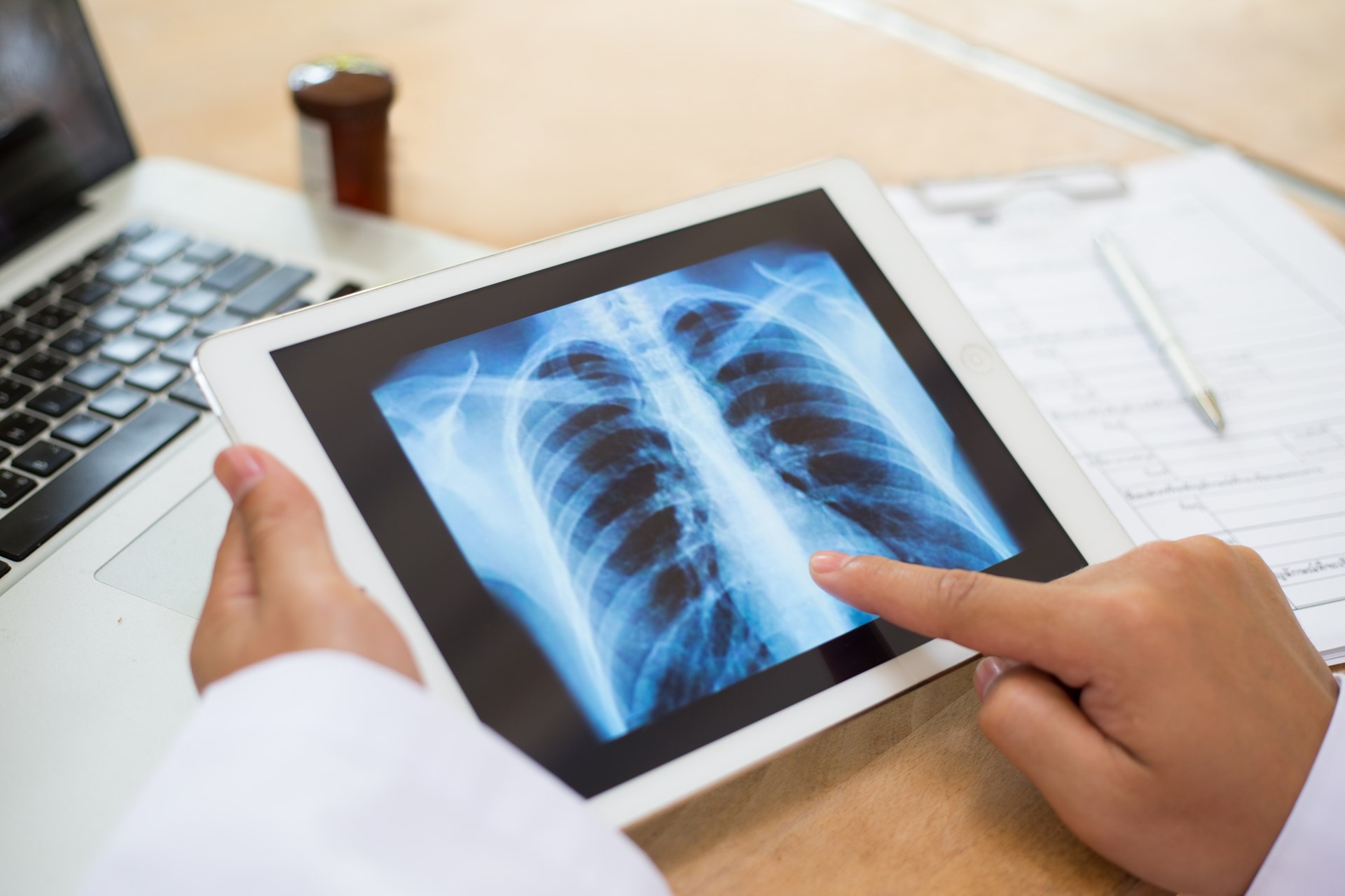 Lung Operation: Breathe Easier, Recover Faster